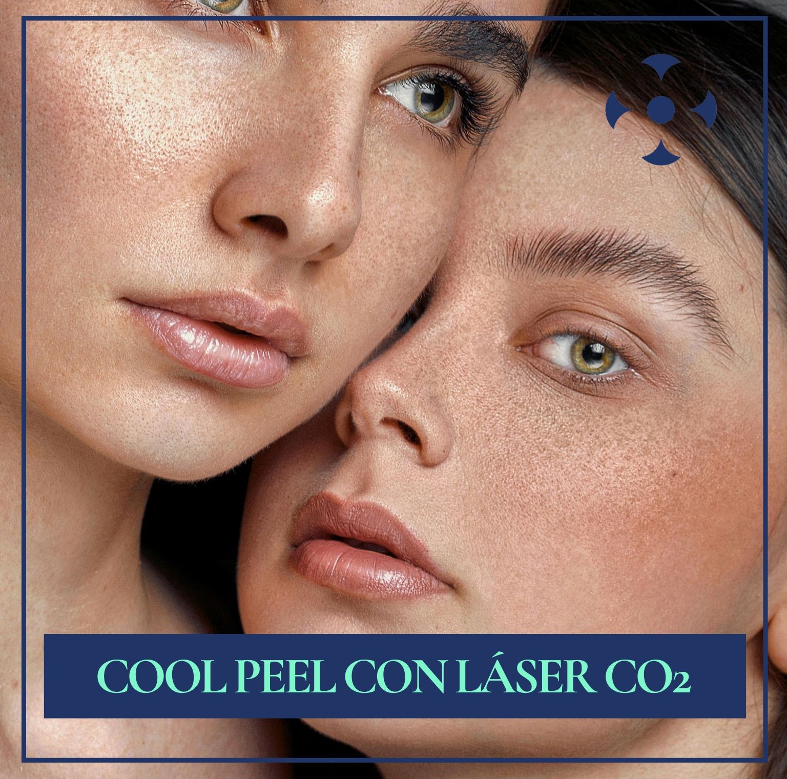 Lee más sobre el artículo Cool Peel